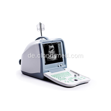 Medizinische tragbare Ultraschall-Diagnosemaschine Digital B